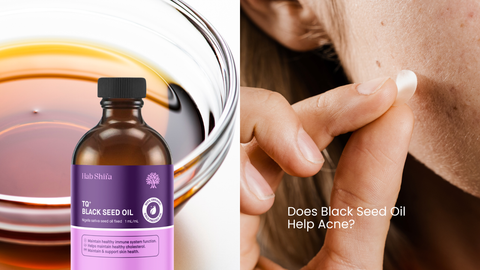 Does Black Seed Oil Help Acne? What the Research Says